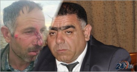 İcra başçısı müavini Xocalı faciəsi günü Xocalı sakinini döydürüb