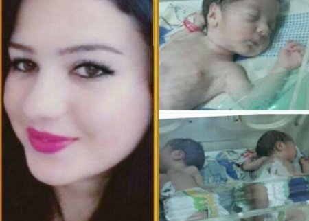 Azərbaycanda əkiz uşaq dünyaya gətirən ana öldü - normadan artıq narkoz verdikləri üçün