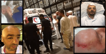 Türkiyəli zəvvarlar Məkkədə bir-birinə girdi: Yaralılar var - FOTO