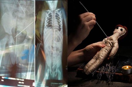 Hindistanda dəhşət — Cadu etmək üçün 3 yaşlı körpəni şişə taxdı