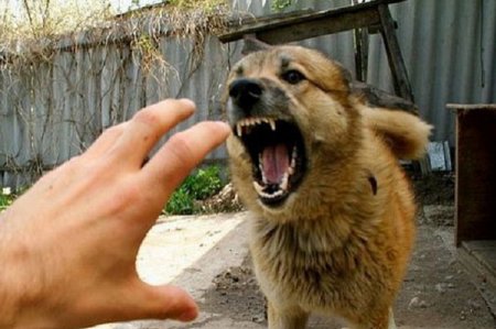 Sumqayıtda 10 nəfəri it dişləyib — 5 yaşlı qız ölümcül vəziyyətdədir