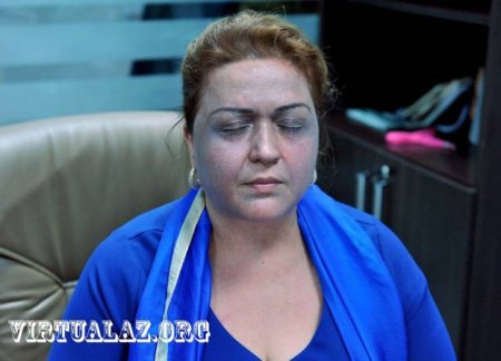 "Vip Style"də daha bir biabırçılıq... - Əliyevanın üzünü necə qaradəriliyə çevirdilər... "Vip Style"də daha bir biabırçılıq... - Əliyevanın üzünü necə qaradəriliyə çevirdilər...