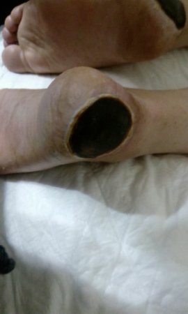 "Vimay" Klinikasında həkim səhlənkarlığının qurbanına çevrilən xəstə