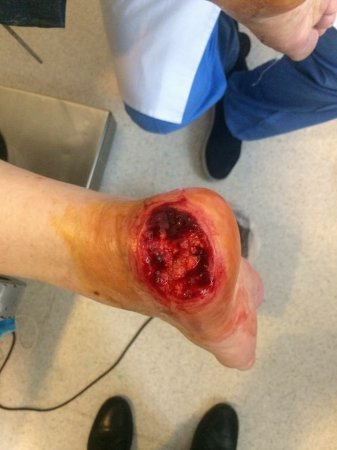 "Vimay" Klinikasında həkim səhlənkarlığının qurbanına çevrilən xəstə