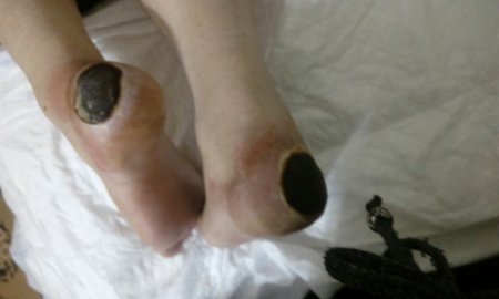 "Vimay" Klinikasında həkim səhlənkarlığının qurbanına çevrilən xəstə