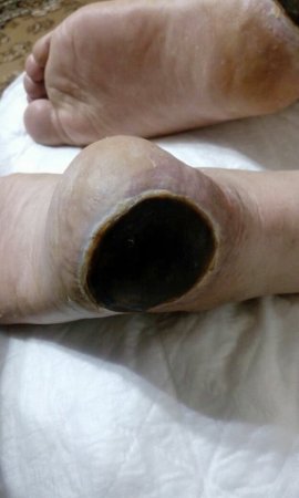 "Vimay" Klinikasında həkim səhlənkarlığının qurbanına çevrilən xəstə