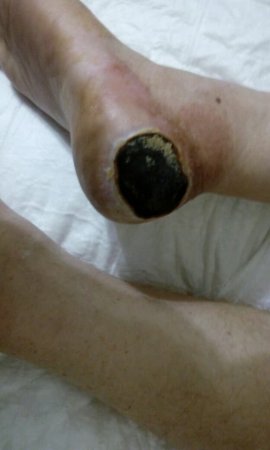 "Vimay" Klinikasında həkim səhlənkarlığının qurbanına çevrilən xəstə