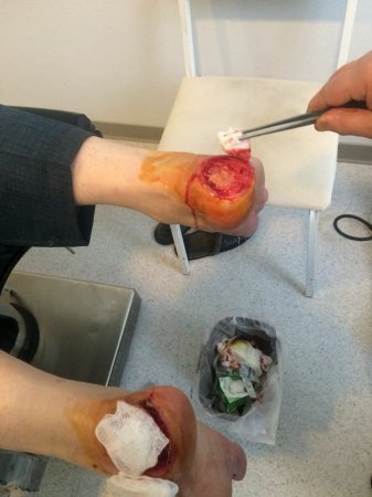 "Vimay" Klinikasında həkim səhlənkarlığının qurbanına çevrilən xəstə