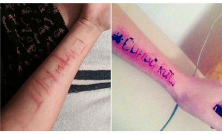 Hövsanda məktəbdə uşaqlar qollarını niyə kəsib?