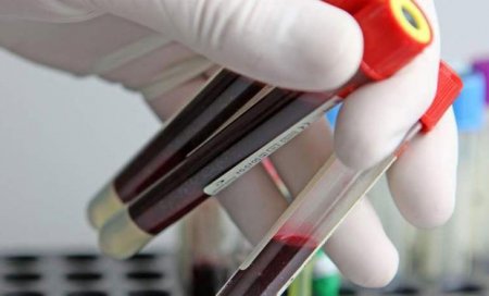 Xərçəng xəstəliyinin yaranmasının başlıca SƏBƏBLƏRİ