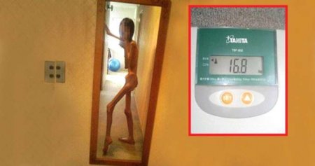 Çəkisi 16.8 kiloya düşdü -SƏBƏBİ...VİDEO / FOTO