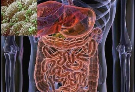 Piylənmə, bağırsaq xərçəngi, diabet və insultdan qoruyan - MADDƏ