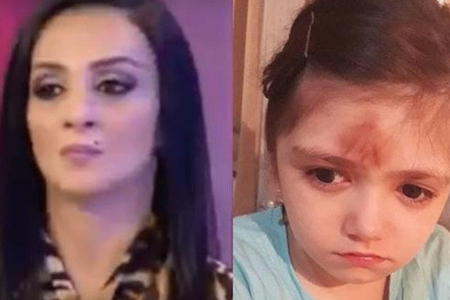 Daha bir döyülən uşaq qalmaqalı – övladını vuran ana həbs edə bilərmi...