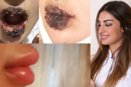 Bakıda qadınlara mənşəyi bilinməyən preparat vurulub – sensasion məhkəmə işi