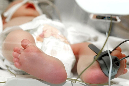 Azərbaycanda 1 yaşadək uşaqların əsas ölüm səbəbləri açıqlanıb