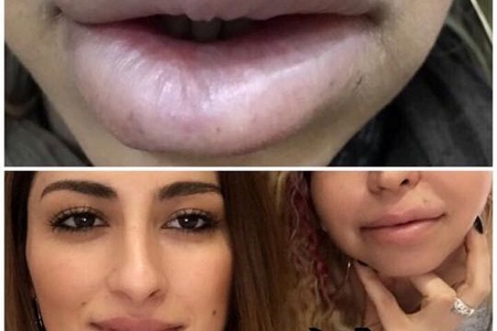 Maşınqayırma ixtisasını bitirən kosmetoloq qadınları dəhşətli hala salıb - FOTOLAR