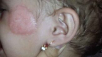 Daha bir bağçada uşağa qarşı şiddət: Üzünə dağ basdılar – FOTOLAR