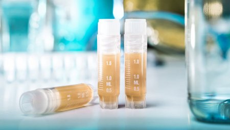 Azərbaycanla sərhəddə dəhşətli virus: 3 nəfər öldü