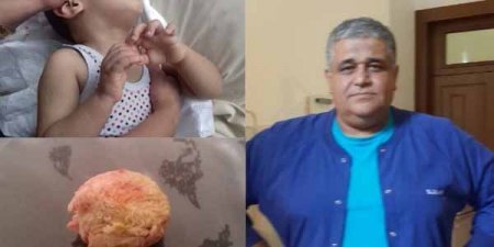 Bakıda cərrah uşağın boğazında görün nə qoydu? (FOTOLAR)