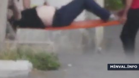 Bakıda dəhşətli olay – Oğru girdiyi evdə bıçaqlandı, qarnında bıçaqla aparıldı