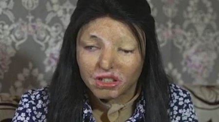 Rəfiqəsinin üzünü “kislota” ilə yandırıb Azərbaycana qaçdı - XƏYANƏTİN QİSASINI ALIB/ VİDEO