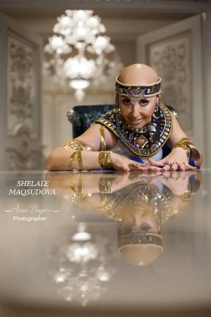 Xərçəngə yoluxan Zülfiyyədən maraqlı - Fotosessiya