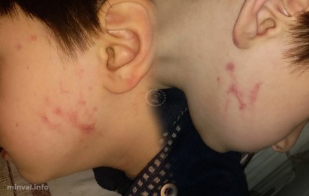 Bağçada uşağa qarşı zorakılıq – Müəllim 5 yaşlı uşağı bu hala saldı? (FOTO) Bağçada uşağa qarşı zorakılıq – Müəllim 5 yaşlı uşağı bu hala saldı? (FOTO)