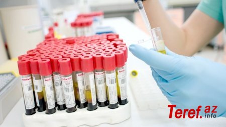 Özəl klinikalarda bir analizdə qiymət uçurumu: -“Baku Clinic” 240, “Medicus” 80 manat 