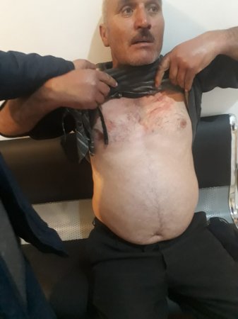 “Aqro Mədrəsə” ASC-nin “çəpərləmə” siyasəti - Şamaxıda aprel şəhidinin ailəsi incidilir - TƏKZİBOLUNMAZ FAKT  