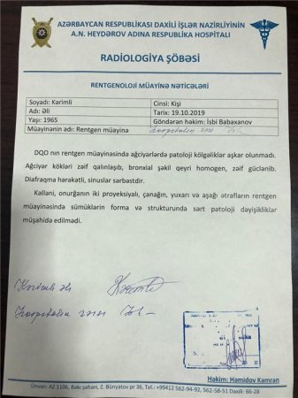 “Əli Kərimli bütün müayinələrdən keçdikdən sonra evə buraxılıb” - DİN Hospitalının rəisi İsbi Babaxanov( SƏNƏDLƏR)