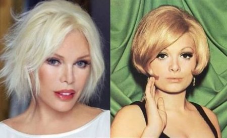 73 yaşlı Ajda Pekkanın estetik əməliyyatlarının sayı açıqlandı