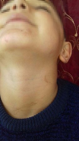 Bakıda ögey ana azyaşlı uşaqlara işgəncə verib - Fotolar