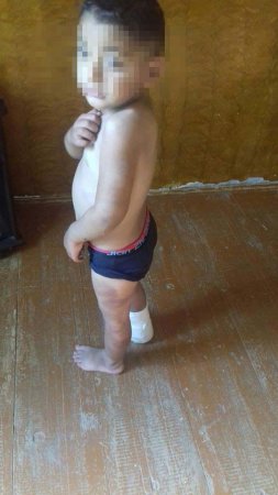 Bakıda ögey ana azyaşlı uşaqlara işgəncə verib - Fotolar