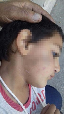 Bakıda ögey ana azyaşlı uşaqlara işgəncə verib - Fotolar