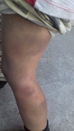 Bakıda ögey ana azyaşlı uşaqlara işgəncə verib - Fotolar