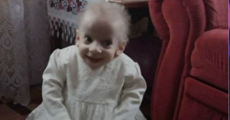 Səkkiz yaşlı uşaq qocalıqdan öldü ..