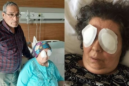 Qadının gözlərini çıxarıb yedi