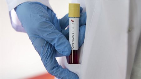 Daha bir ölkədə koronavirusdan ilk ölüm qeydə alındı