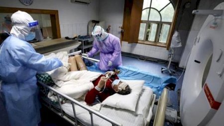 Koronavirusdan sağalan xəstələrin ağciyərləri bu hala düşür - Araşdırma