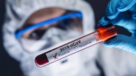 Azərbaycanda daha 61 nəfərdə koronavirus aşkarlandı
