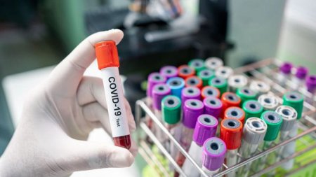 Azərbaycanda koronavirusa yoluxanların ümumi STATİSTİKASI