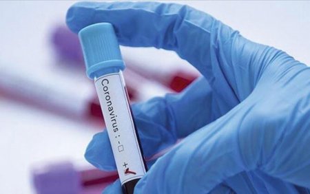 Koronavirus dərmanı ilə bağlı daha bir iddia
