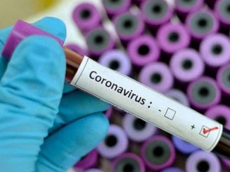 Azərbaycanda daha 104 nəfərdə koronavirus aşkarlanıb - Bir nəfər ölüb