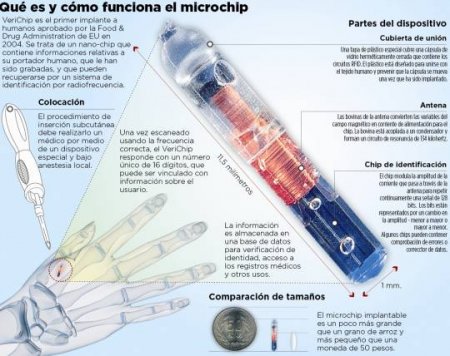 Avropada minlərlə insan dəriləri altına çip yerləşdirilməsinə razılıq verir – ƏSL CƏHALƏT BAŞLANDI!..