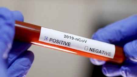Azərbaycanda daha 49 nəfərdə koronavirus aşkarlandı - 1 nəfər vəfat etdi