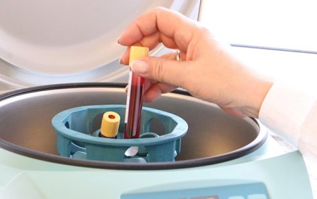 Azərbaycanda daha 56 nəfərdə koronavirus aşkarlandı - 53 nəfər sağaldı