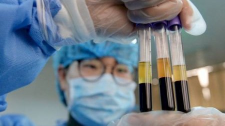 COVİD-19 daşıyıcılarının sayına görə Türkiyə Çini keçdi