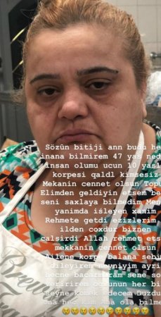 Rəqsanənin yanında işləyən qadın koronavirusdan öldü - Foto