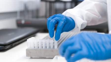 Azərbaycanda koronavirusla bağlı testlərin sayı 200 mini keçdi - RƏSMİ