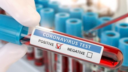 Ermənistanda bir gündə 322 nəfərdə koronavirus aşkarlandı